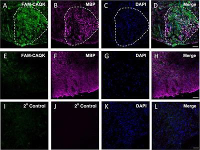 CAQK, a peptide associating with extracellular matrix components targets sites of demyelinating injuries